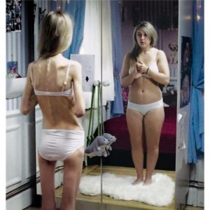 Anorexia-nervosa-300x300-2